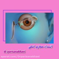 انیمیشن انسداد مجرای اشکی