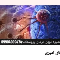 پزشکان ایرانی برای اولین بار موفق به درمان پروستات گردیدند.