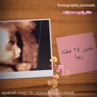 جنین 25 هفته ای