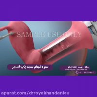 فیلم انجام تست پاپ اسمیر