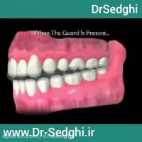 دندان قروچه