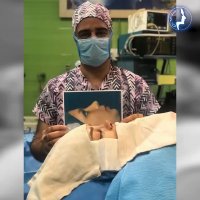 عمل زیبایی بینی فانتزی | دکتر گلی