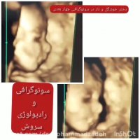 سونوگرافی 4 بعدی