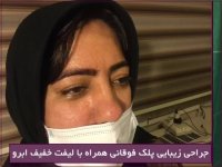 جراحی پلک فوقانی