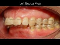 ارتودنسی دندان