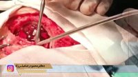 فیلم واقعی خارج ساختن لخته خون از مغز یک خانم 18 ساله
