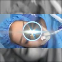 جراحی زیبایی بینی