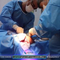 کاشت مو - 02632402304