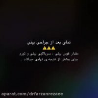 فیلم جراحی بینی بسته