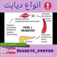 انواع دیابت | انجمن دیابت شرق