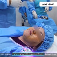 تزریق چربی - 02632402304