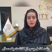 هزینه کاشت ابرو