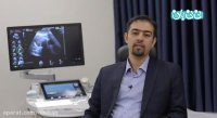 سونوگرافی های ضروری در بارداری
