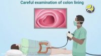 در حین و بعد از کولونوسکوپی چه می گذرد؟!؟
