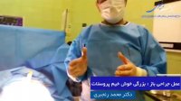 فیلم عمل جراحی پروستات بزرگ خوش خیم