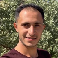 کاشت مو | کلینیک تخصصی رنسانس  021-22088210