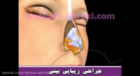 جراحی زیبایی بینی