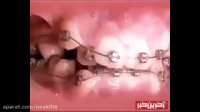ارتودنسی دندان | کلینیک دندانپزشکی