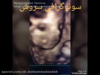 سونوگرافی 4 بعدی متحرک جنین 16 هفته