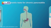 همه چیز درباره بیماری پانکراتیت