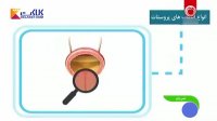 انواع عفونت پروستات و علائم آن