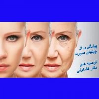 توصیه های پروفسور کشکولی درباره جلوگیری از چینهای صورت | جراح پلک تهران