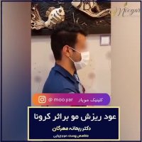 عود ریزش مو بر اثر کرونا