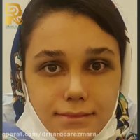 فیلم کامل عمل بینی