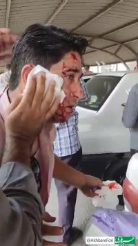 ترکیدن شیشه و زخمی‌شدن افراد بعد از انفجار در بندر شهید رجایی