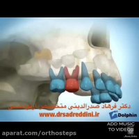 مراحل ارتودنسی