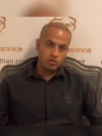 کاشت مو رنسانس