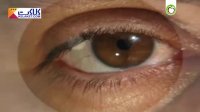 ساختمان و عملکرد چشم - قسمت دوم