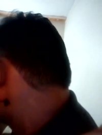 زالو انداختن پشت گوش و گردن  بهزاد زمانی