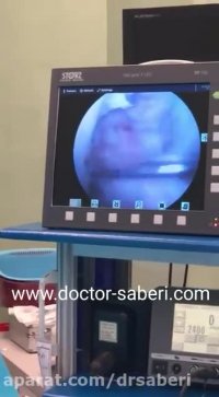 فیلم جراحی ارتوپدی