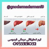 کلیپ جدید علائم کبد چرب