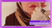 فیلم تزریق ژل خنده