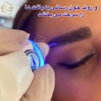 کاشت ابرو تخصصی