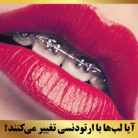 ارتودنسی غرب تهران | دکتر داوودیان