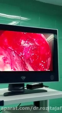 فیلم جراحی مننژیوم مغزی