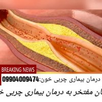 چگون دچار چربی خون می شویم؟درمان این بیماری چیست؟