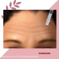 فیلم واقعی تزریق بوتاکس