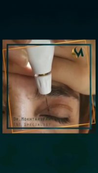 پلکسر پلاس فرکشنال