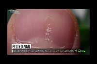 ناخن ها درباره سلامتی بدن شما چه می گویند