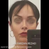 عمل های همزمان جوانسازی صورت