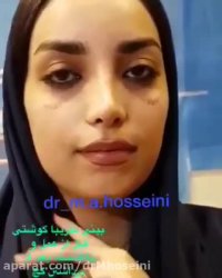 بینی تقریبا گوشتی