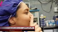 فیلم عمل جراحی زیبایی بینی دکتر شبنم شادابی