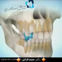 مراحل رشد دندان