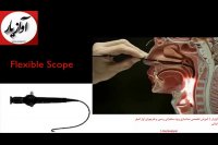 ابزار معاینه حنجره لارنگوسکوپی و استروبوسکوپی
