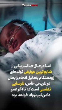 رابطه تاریخ تولد لاکچری و افزایش اوتیسم