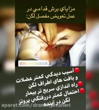 مزایای تعویض مفصل لگن از طریق برش قدامی